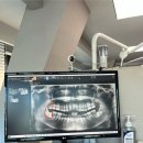 5층사랑약국 | 사랑이아프니 강남점: 미루고미루던 매복사랑니 발치후기(예약, 비용, 2달후기)