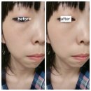 직접 써본 쿼드쎄라 리얼 후기! 4주간 변화된 피부 상태