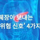 췌장이 보내는 '위험 신호' 4가지 이미지