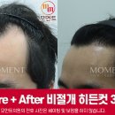 모먼트의원 이미지