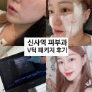 소다성형외과의원 | 신사역 V턱패키지 얼굴 윤곽관리 후기