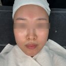 필바이오 | [대전 탄방동] 피부관리맛집 뷰티인사이드에서 바이오리필 슈렉필 받은 후기