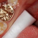 다온치과기공소 이미지