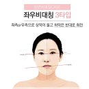 3D안면비대칭교정
