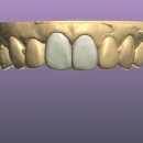 새로치과기공소 이미지