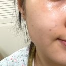 아드망 | 항산화 로션 아드망 항당화 시니지 리페어 로션 실사용 후기