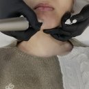 [대구 수성구 피부관리] 디자인라인스튜디오 엑소필 후기