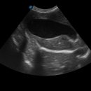 (주)유티비 이미지
