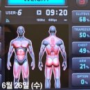 애드스파EMS 이미지