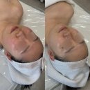 상무지구 피부관리 보니토에스테틱 예민피부 진정 받고 되살아난 후기