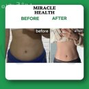 미라클헬스 이미지