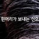 흰머리가 보내는 건강 적신호 이미지