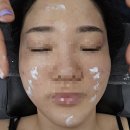 [구래동여드름관리]여드름부터 리프팅까지 한 번에 케어! 초이스뷰티 방문후기