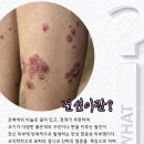 대전명한의원 네이버블로그