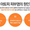 엔젤아이의원 이미지