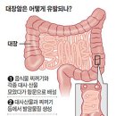 대장암 사망률 15년 새 73％ 증가 이미지