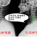 교통사고후 어떤 치료로도 통증이 개선되지 않던 경우의 치료사례 이미지