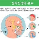 삼차신경통 통증 원인 이미지