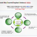 지니솔루션