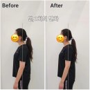 송도랜드마크정형외과의원 네이버블로그