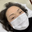 늘푸른수지 | 푸른눈썹 잔흔제거후 자연스런복구눈썹 완성, 틴트입술 반영구 후기