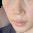 뷰앤플의원 이미지