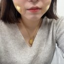 보조개 | 비절개 보조개 내돈내산 후기✨ (feat. 2일차)