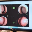 서호유치원 | [후기] 7살 아이, 라경찬 한의원 비염 치료 후기 1탄