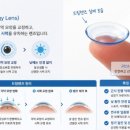 글라스플라이 안경원 | 안경 vs 근시 억제 안경 vs 드림렌즈vs안약... 과연 부모의 선택은?, 우리 아이 생애 첫 근시억제안경 후기