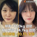 논현어린이집 | 인천논현다이어트 얀코치의 리얼 회원 후기_7