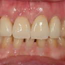 다연치과기공소 이미지