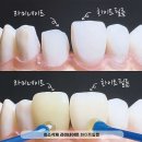 동남치과의원 티스토리