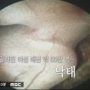 필리핀 여성의 낙태 실상 이미지