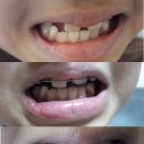 김현우치과의원 네이버블로그