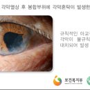 홍채안경원 네이버블로그