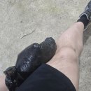 이춘택병원 | 전방십자인대 재파열 수술 후기 (이춘택병원)