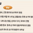 수전증，‘떨리는 손’ 내몸의 이상신호 이미지