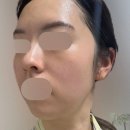 미래피부과의원 - 전주시 덕진구 기린대로 465 | 제이필의원 홍대입구역피부과 초음파 재생관리 리뷰, 정보, 후기