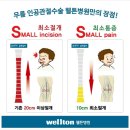 송상호원장* 고관절 못자고 못걷는 무릎통증이라면 &#39;무릎인공관절수술&#39; / 오다리교정 /웰튼병원곧은다리프로젝트 이미지