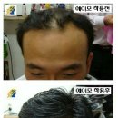 에이모가발