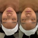 경남빌딩 | 김해 골드테라피 1회만으로 안색 변화 솔직 후기