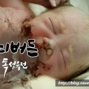 통증N바디테라피 이미지