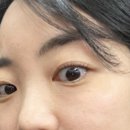 EYE이뻐 이미지