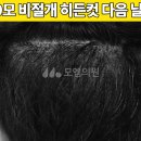 모엠의원 Daum카페