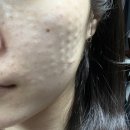 5월 소비 기록 (데체코 파스타면, 질유산균, 마켓컬리, 리쥬란HB )