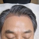 의정부 헤어라인 문신 잘하는곳 제나브로우 자연스럽게 채운 후기