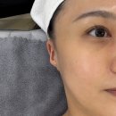 첨단 베리윤뷰티 셀플랜 후기 :: 광채 피부 완성