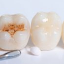 가족치과의원 | 이가 아프면 무조건 가야 하는 곳! 부천청담네오플란트치과의원 솔직 후기