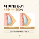조이플성형외과의원