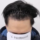 더헤어라인성형외과의원 이미지